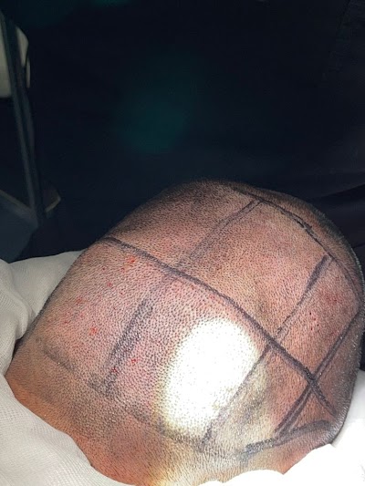 Medical Hair