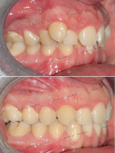 Clínica Dental Dávalos & Balboa