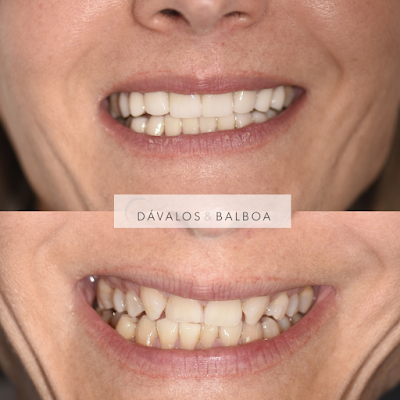Clínica Dental Dávalos & Balboa