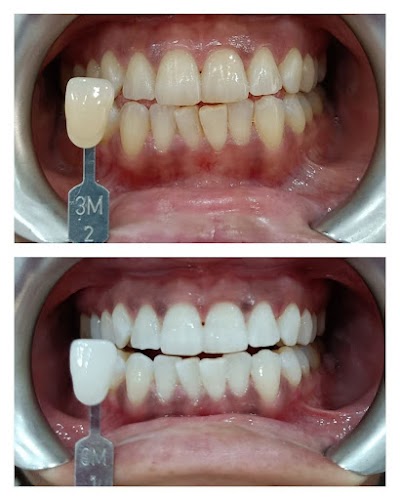 Clínica Dental Dávalos & Balboa
