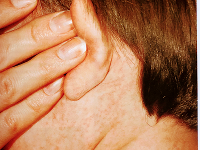 Clínica Dermatológica Dr.Domínguez Silva